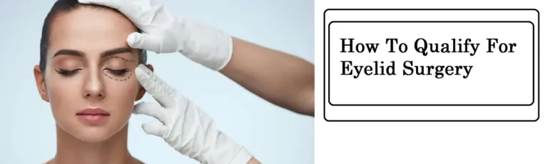 how to qualify for eyelid surgery